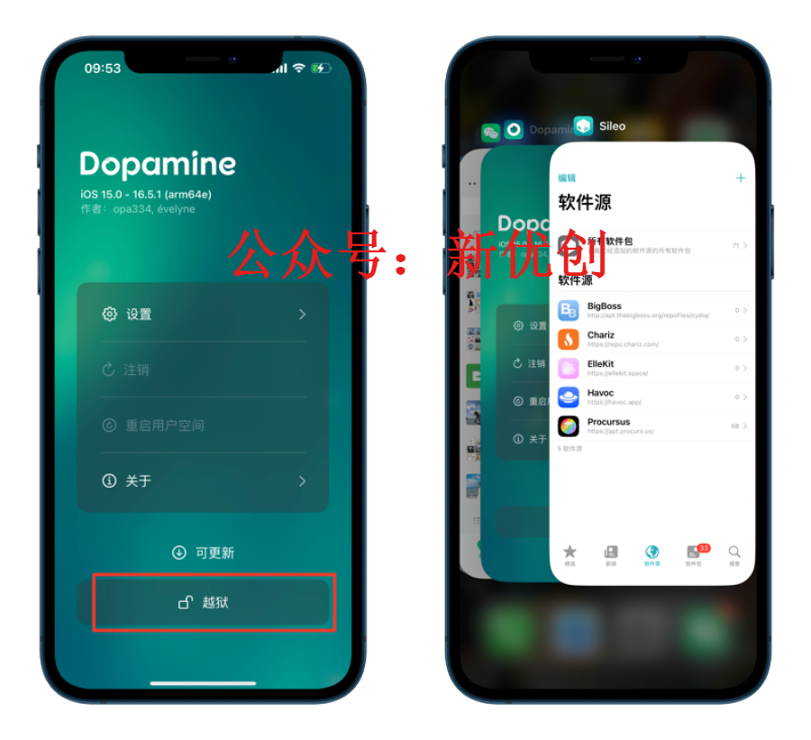 Dopamine 多巴胺